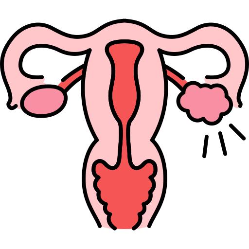 Endometriose (Tratamento Clínico e Cirúrgico)